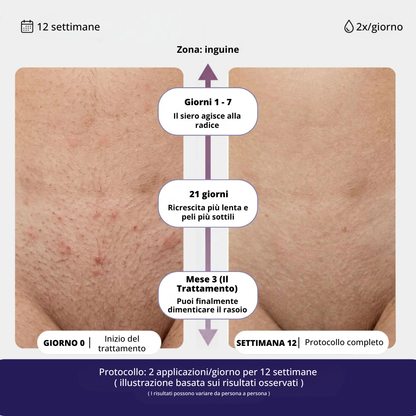 Siero Anti-Ricrescita